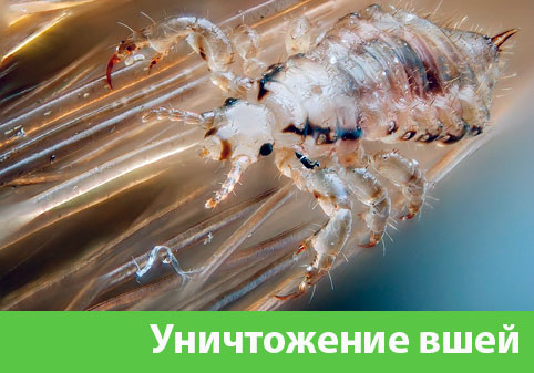 Уничтожение вшей в городе Тольятти